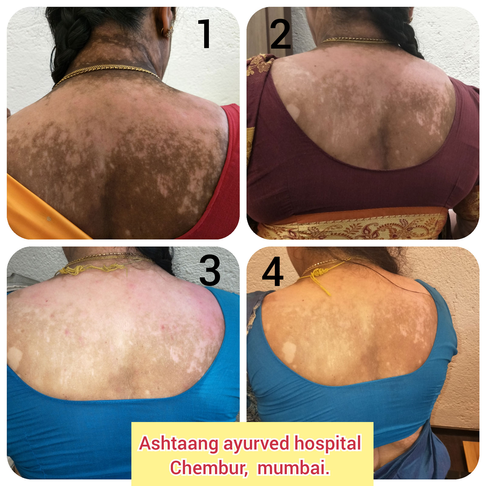 CollageMaker_20180520_113050715.jpg