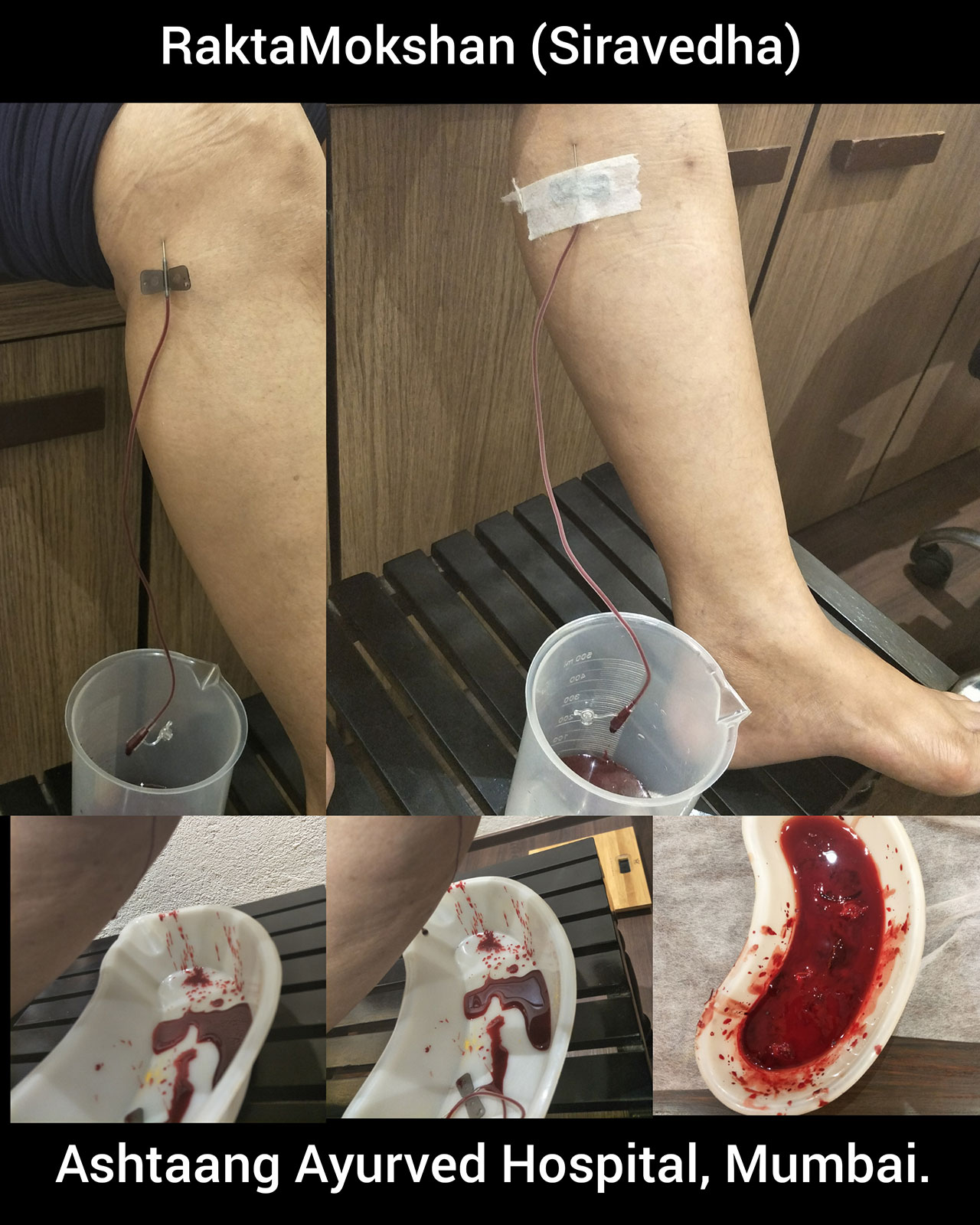 CollageMaker_20180520_115714039.jpg