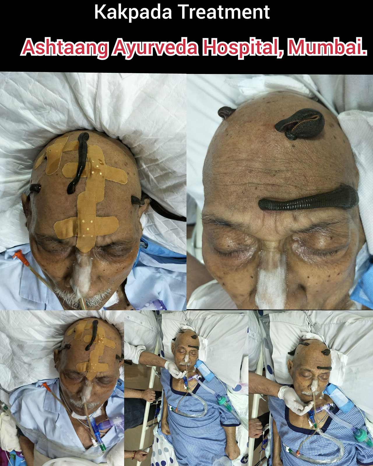 CollageMaker_20180520_120126189.jpg