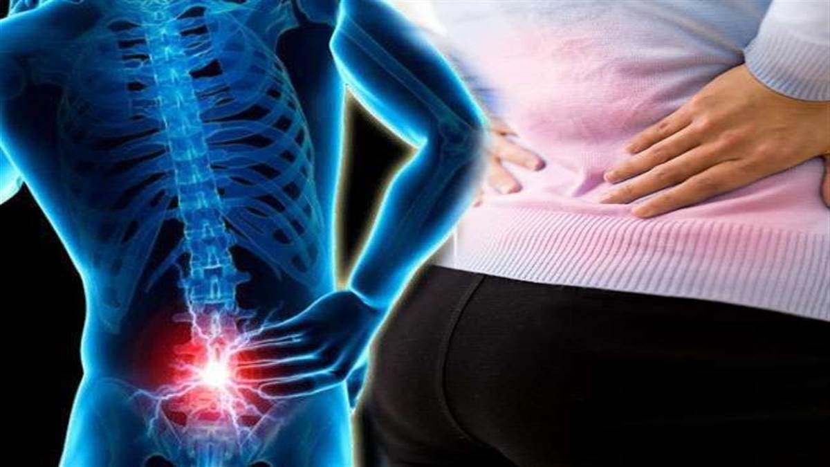 Sciatica